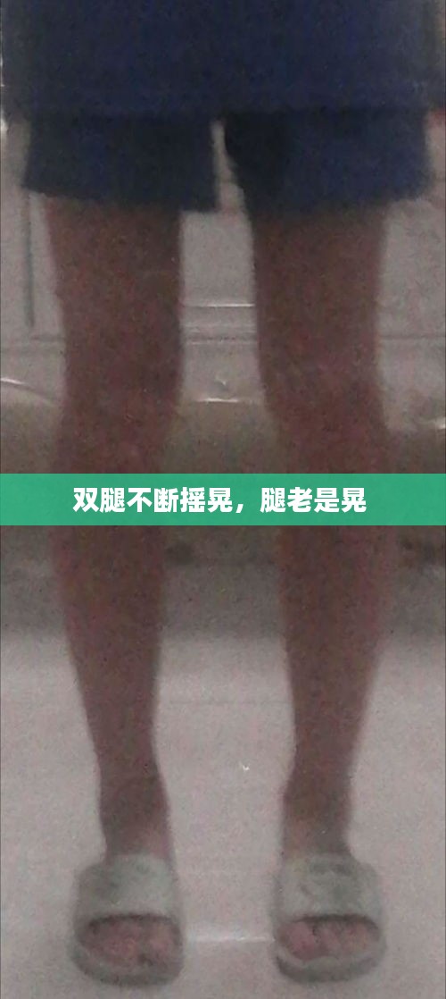 双腿不断摇晃，腿老是晃 