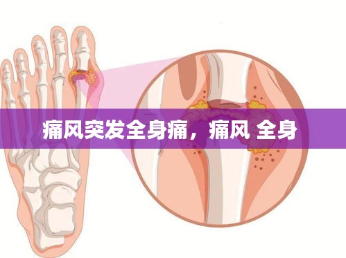 痛风突发全身痛，痛风 全身 