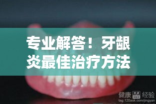 专业解答！牙龈炎最佳治疗方法，轻松解决牙齿疼痛问题！